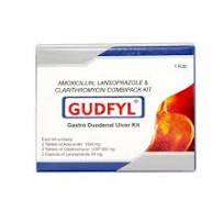 Гүдфил кит №60